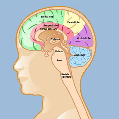 Thalamic Gliomas | Thalamic Glioma Registry